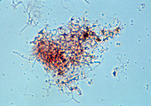 Colony of Streptomyces griseus bacteria