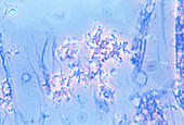 Extremophile bacteria Thiobacillus