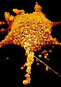Mycoplasmas on HeLa cell