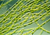 Filamentous alga,Ulothrix fimbriata