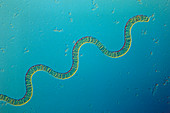 LM of Spirulina platensis cyanobacteria