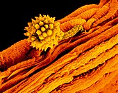 Germinating goldenrod pollen grain