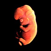 Embryo at 54 days