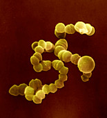 SEM of Streptococcus