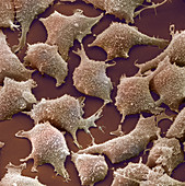 Human Fibroblast Cells