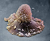 Carcinoma Cell Apoptosis