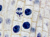 'Onion Root Tip,Cell Mitosis'