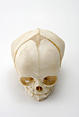 Human Fetal Skull