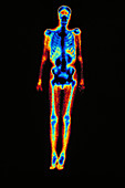 Cancer gamma scan