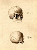 Physiognomical Illustration of Human Skul