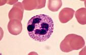 Leukocyte Drumstick