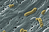 Vibrio cholerae