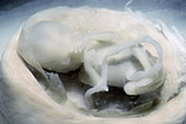 Human fetus at 14 weeks