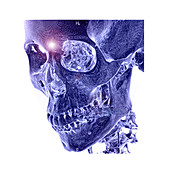 Normal Human Skull