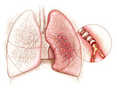 Illustrating Asthma