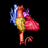 Color Enhanced 3D CTA of Heart