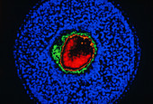 Normal Heart,Scintigram