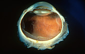 Human Eye in Section