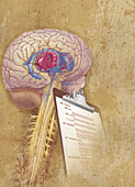 Parkinson's Disease Illustration