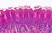 Fungiform Papillae,LM