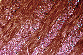LM of Striated Muscle