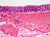 Mammalian Trachea