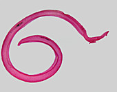 Schistosoma Liver Fluke