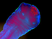 Taenia Solium Larva Anterior