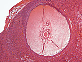 Oocyte in Rabbit Ovary