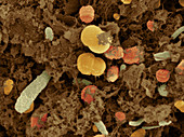 SEM of Cow Feces Bacteria