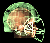 Football Helmet,X-Ray