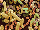 Urine Contaminated by Bacteria SEM