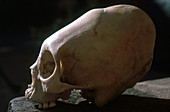 Deformed Incan Skull