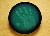 Bacteria Transferred From Hand
