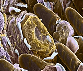 Taste Bud and Papillae,SEM