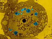 TEM of Baculovirus
