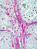 Spiral Tracheids in Mistletoe Leaf (LM)