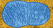 Stages of Mitochondrial Division,TEM