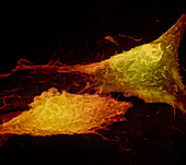 Prostatic Cancer Cells