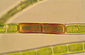 Chlamydospores in Microspora sp. Algae