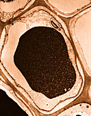 Pine Needle,Tannin Cell