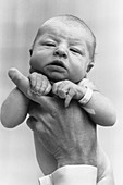 Newborn in Pediatrician's Hand