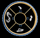 Breast Biopsy Samples