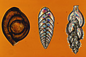 Foraminifera (LM)