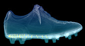 X-ray of Shoe