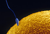 Single Sperm Fertilizing an Egg,SEM
