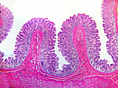 LM of Stomach Wall