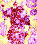 Human T-lymphocyte Showing HIV