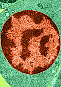 Polychromatophilic Erythroblast,TEM