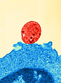 Theileria parva Infecting Lymphocyte,TEM